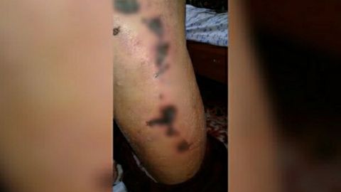Наманганда хотинини кетмон билан калтаклаган эркакка жиноий иш қўзғатилди