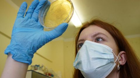 Ҳиндистонда тарқалган қора замбуруғ инфекцияси Россияда ҳам қайд этилди