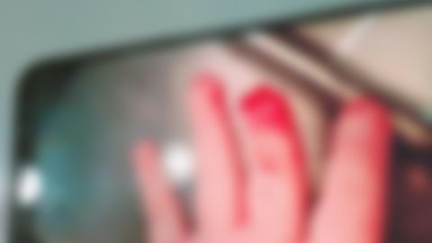 Хоразмдаги хусусий боғчада тарбиячиларнинг эътиборсизлиги сабаб 2 ёшли боланинг бармоғи кесилиб кетди