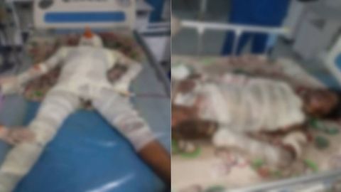 Andijonda temiryo‘l vagoni ustiga chiqqan 13 yoshli bolani yuqori kuchlanishli elektr toki urdi