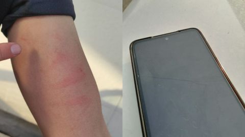 Andijonda bir guruh shaxslar “Effect.uz” jurnalistini kaltakladi. Viloyat prokuraturasi holatni o‘rganishni boshlagan
