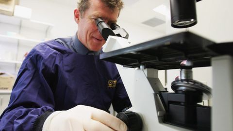 AQShda dori-darmonlarga chidamli va o‘limga olib keluvchi zamburug‘ infeksiyasi avj oldi