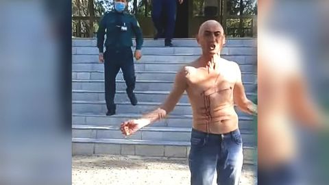 Surxondaryoda muqaddam 7 marotaba sudlangan erkak IIB xodimlaridan norozi bo‘lib lezviya bilan tanasiga jarohat yetkazdi