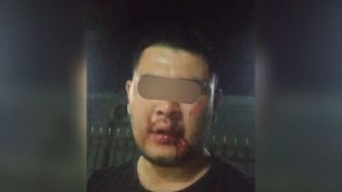 Andijonda fuqaro IIB xodimlari tomonidan kaltaklangani haqidagi xabar yuzasidan ma’lumot berildi