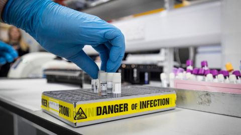 Olimlar koronavirus bundan 21 ming yil oldin ham mavjud bo‘lganini aniqladi