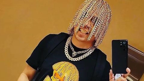 Мексикалик хонанда Dan Sur бошига тилла занжирлар имплантация қилинган тарихдаги илк рэпер бўлганини маълум қилди