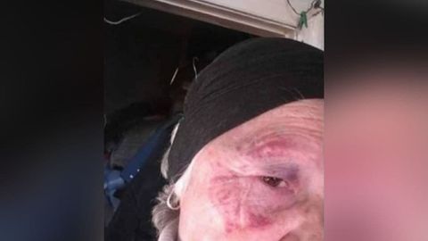 Тошкент вилоятида кекса аёлни уйида ит боққани учун ўлдирмоқчи бўлишди