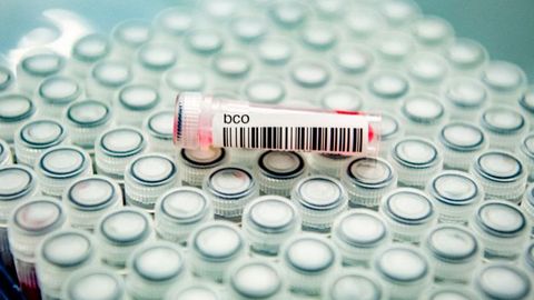 Xitoy koronavirus manbasini aniqlash uchun Uxandagi minglab qon namunalarini o‘rganadi