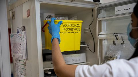 «Вазият назоратдан чиқиб кетгунча кутиб ўтиришни истамаймиз». ЖССТ маймунчечак туфайли фавқулодда қўмита йиғилишини ўтказади