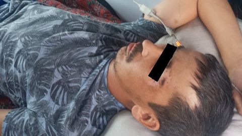 Rossiyada balandlikdan yiqilib, og‘ir tan jarohati olgan O‘zbekiston fuqarosi ortga qaytarildi