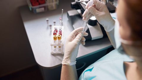 Kosta-Rikada maymunchechak bilan ilk kasallanish holati aniqlandi