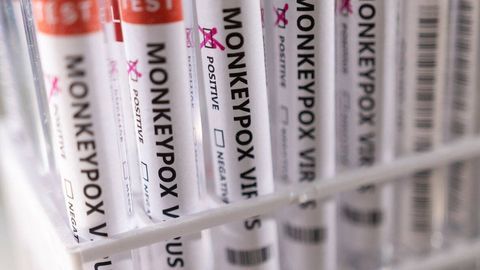 Ҳиндистонда маймунчечак билан касалланган бемор вафот этди