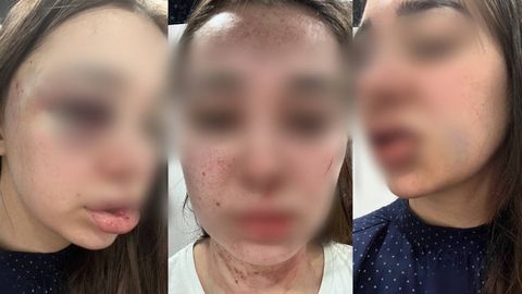 Toshkentda ayolini 7 yildan beri kaltaklab kelgan erkak qamoqdan chiqarildi