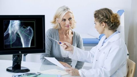 Osteoporoz haqida har bir ayol bilishi kerak bo‘lgan 5 ta muhim jihat