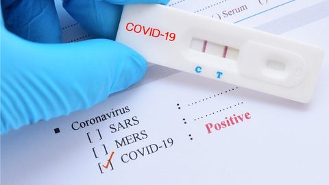 Uzbekistan registers 69 new coronavirus cases