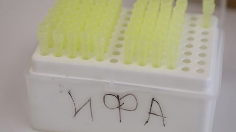 Ўзбекистонда сўнгги суткада 137 кишида коронавирус аниқланди