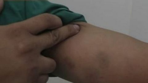 Surxondaryoda shifokorni kaltaklaganlarga nisbatan jinoyat ishi qo‘zg‘atildi