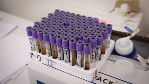 Ўзбекистонда сўнгги суткада 131 кишида коронавирус аниқланди