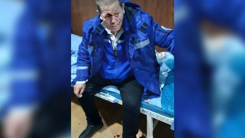 Farg&lsquo;onada tez yordam xodimi shifokorlar kunida kaltaklandi