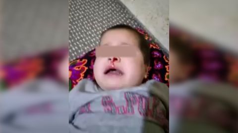 Samarqandda yosh bolasini shafqatsizlarcha kaltaklagan ayolga jinoyat ishi qo‘zg‘atildi