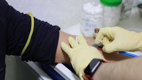O‘zbekistonda OIV bilan kasallanganlar soni ochiqlandi