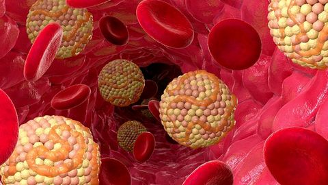 Qondagi xolesterin miqdorini qanday qilib kamaytirish mumkin?