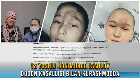 Оққон хасталигига чалинган болага 1400 АҚШ долларлик дори керак (видео)&nbsp;