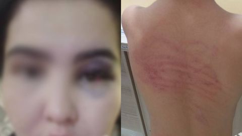 Toshkentda sportchi erkak o&lsquo;z farzandini ayovsiz kaltaklaganining sababi ma&rsquo;lum bo&lsquo;ldi&nbsp;