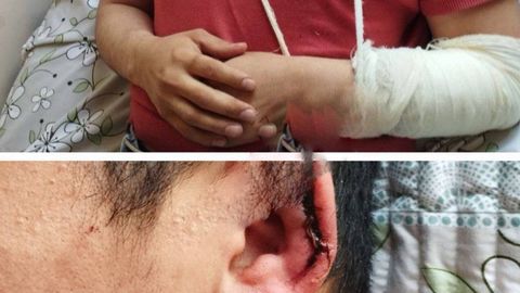 Andijonda shifokor bemorning yaqinlari tomonidan kaltaklandi