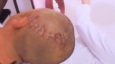 В Фергане мужчина разбил камнем голову продавцу мебели