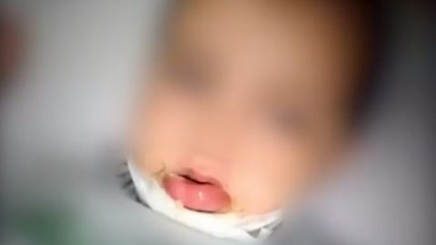 Сурхондарёдаги боғчада қизалоқ каравотдан йиқилиб, шифохонага олиб кетилди
