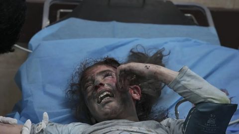 Ғазода ярадорлар наркозсиз ампутация қилинмоқда — ЖССТ