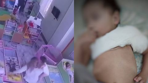 Тошкентдаги хусусий боғчада&nbsp;болага тан жароҳати етказилди (видео)