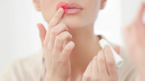 Лабга нима сабабдан учуқ чиқади ва уни қандай даволаш мумкин?