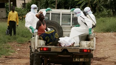 Tanzaniyada odamlar orasida noma&rsquo;lum kasallik tarqalmoqda