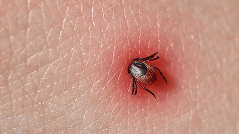 Клещи покусали полмиллиона жителей Алматы за три месяца&nbsp;