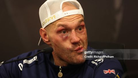 Tayson Fyuri: &ldquo;Bu jangda men g&lsquo;alaba qozongandim. Usik atigi bir nechta raundni oldi&rdquo;&nbsp;