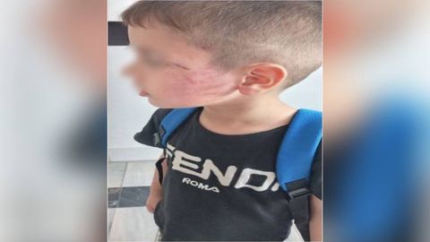 Buxoroda erkak o&lsquo;g&lsquo;li bilan urishgan 5 yashar bolani kaltakladi&nbsp;