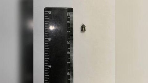 Москва вилоятида қорнида ўқ бўлган бола дунёга келди (фото)