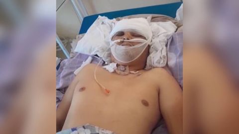 ИИБ ходимлари Оққўрғондан Бўкага, ундан Бекободга олиб кетган фуқаро вафот этгани маълум бўлди. Марҳумнинг яқинлари у уриб ўлдирилган демоқда