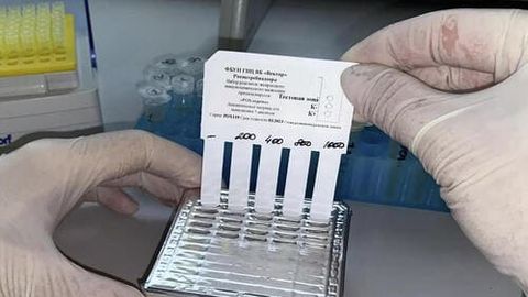 Rossiya O&lsquo;zbekistonga maymunchechakni aniqlash uchun test tizimlarini yuboradi