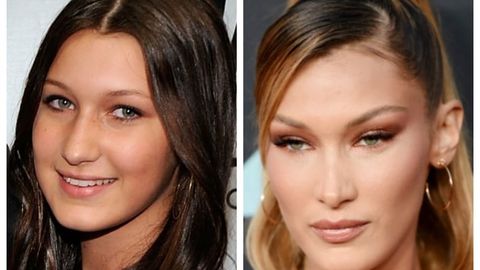 Muvaffaqiyatli karyera uchun: plastik jarrohlik tufayli yanada go&lsquo;zallashgan yulduzlar (foto)&nbsp;