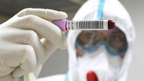 Rossiyada koronavirusning yangi XEC varianti aniqlandi&nbsp;