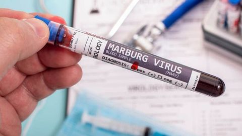 JSST Marburg virusining global epidemiyasi xavfidan ogohlantirdi&nbsp;