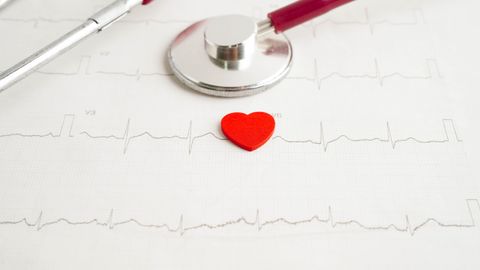 Qanday holatda zudlik bilan yurakni EKG va UTT tekshiruvidan o&lsquo;tkazish lozim? Kardiolog tavsiyalari