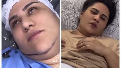 Toshkentdagi xususiy klinikada reklama evaziga liposaksiya qildirgan bloger Komila Abduqodirovada operatsiyadan so&lsquo;ng nekroz yuzaga keldi&nbsp;