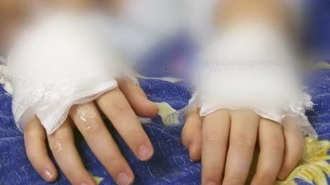 В Алмалыке вынесен приговор женщине, прижигавшей пальцы 8-летнему сыну за съеденные сладости