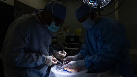 Dunyoda ilk marta&nbsp;inson qovug&lsquo;i ko&lsquo;chirib&nbsp;o&lsquo;tkazildi