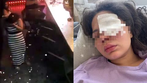 Toshkentda tungi klub menejeri mijoz tomonidan otilgan “xlopushka” sabab ko‘zidan og‘ir jarohat oldi