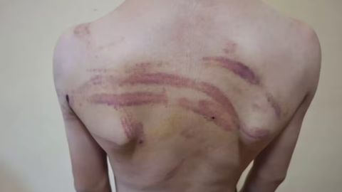Surxondaryoda hujra tashkil qilib, bolalarni qiynoqqa solib kelgan yigit qo&lsquo;lga olindi (video)&nbsp;